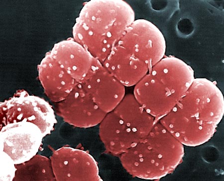 Medicina Regenerativa: descubre como una bacteria muerta vuelve a revivirse